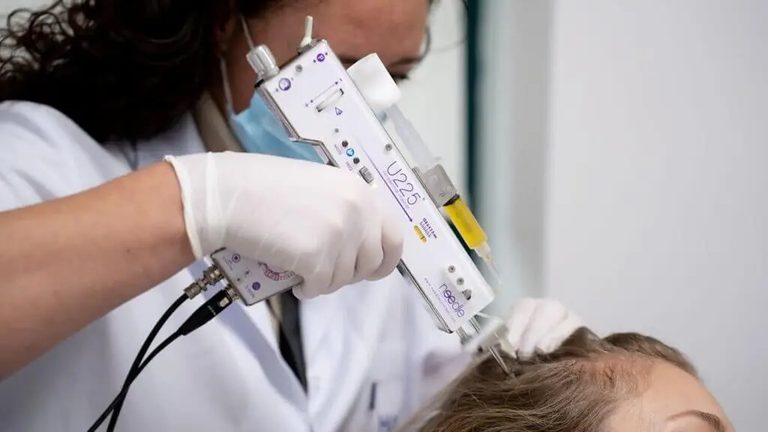 Close-up van de meso-injector op de hoofdhuid tijdens een PRP-behandeling bij Hairtec