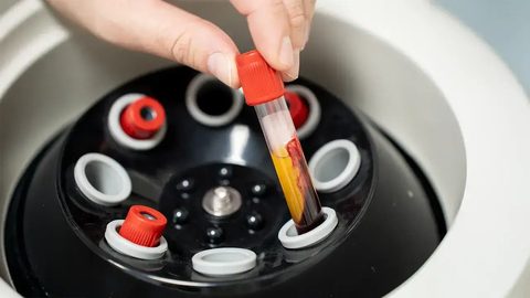Bloedbuisjes in de centrifuge: zo wordt het plasma in onze kliniek in Delft bereid