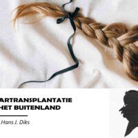 Haartransplantatie In Het Buitenland: Is Het Veilig?