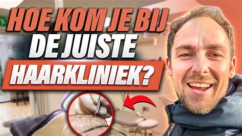 Hoe Kies Ik De Juiste Haartransplantatie Kliniek?