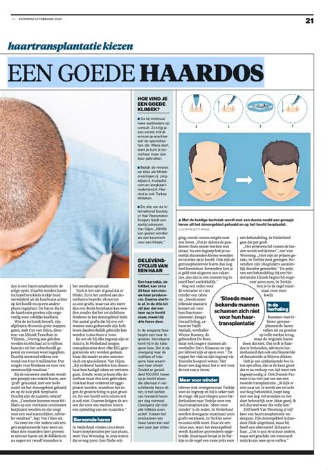 Haartransplantatie: Waarom Advies Van Experts Belangrijk Is